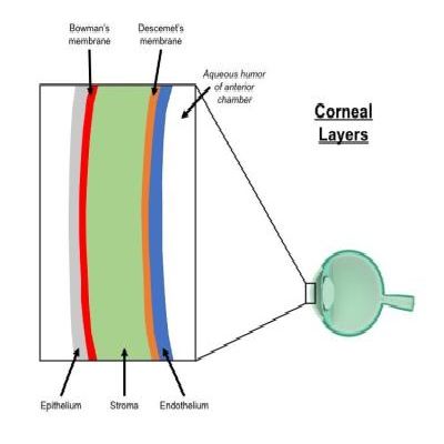 Cornea Suitability Factors